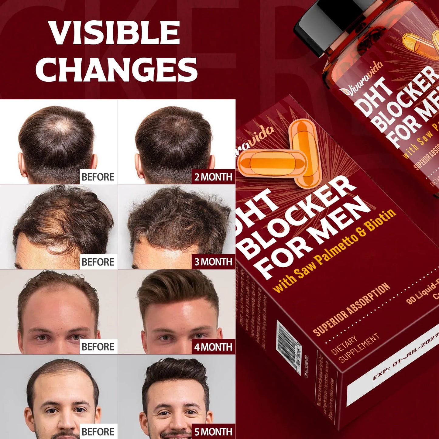 Bloqueador De Dht Para Hombres Crecimiento Saludable Del Cabello Con Biotina Y Palma Enana