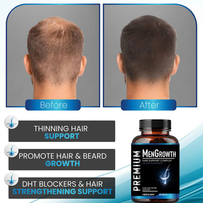 Vitaminas Crecimiento Cabello Hombres Anti Caída Con Bloqueador DHT