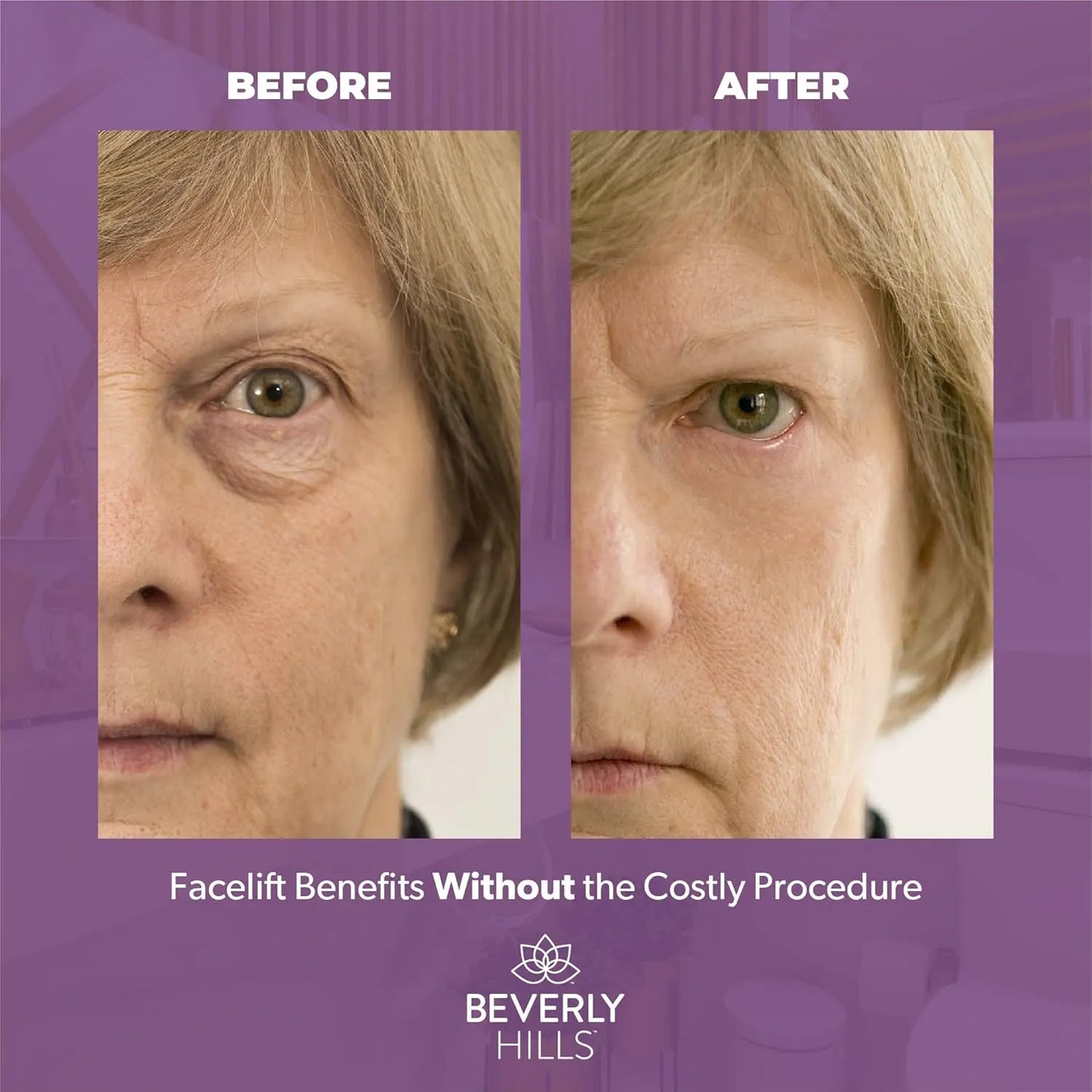 Beverly Hills Suero Instantaneo Antienvejecimiento Ojeras