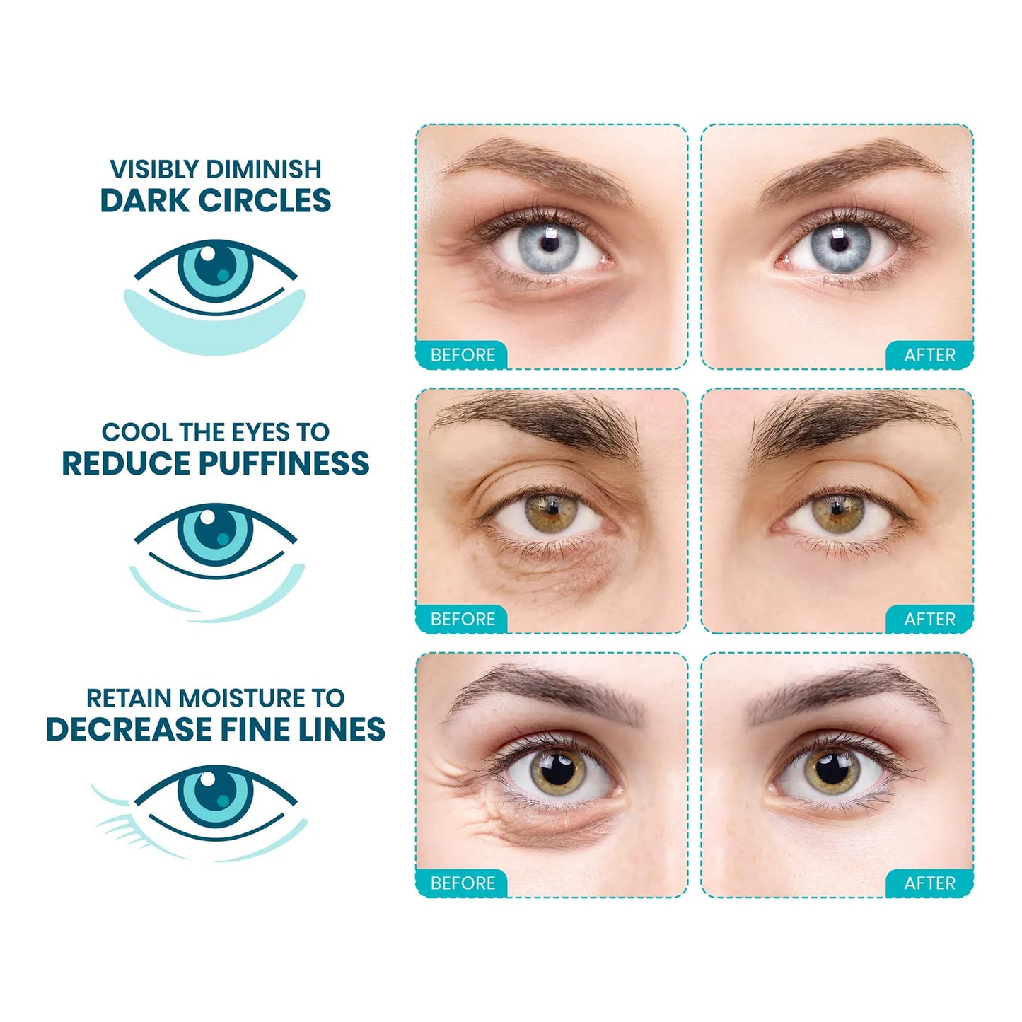 Parches Hidratantes Para Ojeras Y Ojos Hinchados Con Colágeno 30 Pares