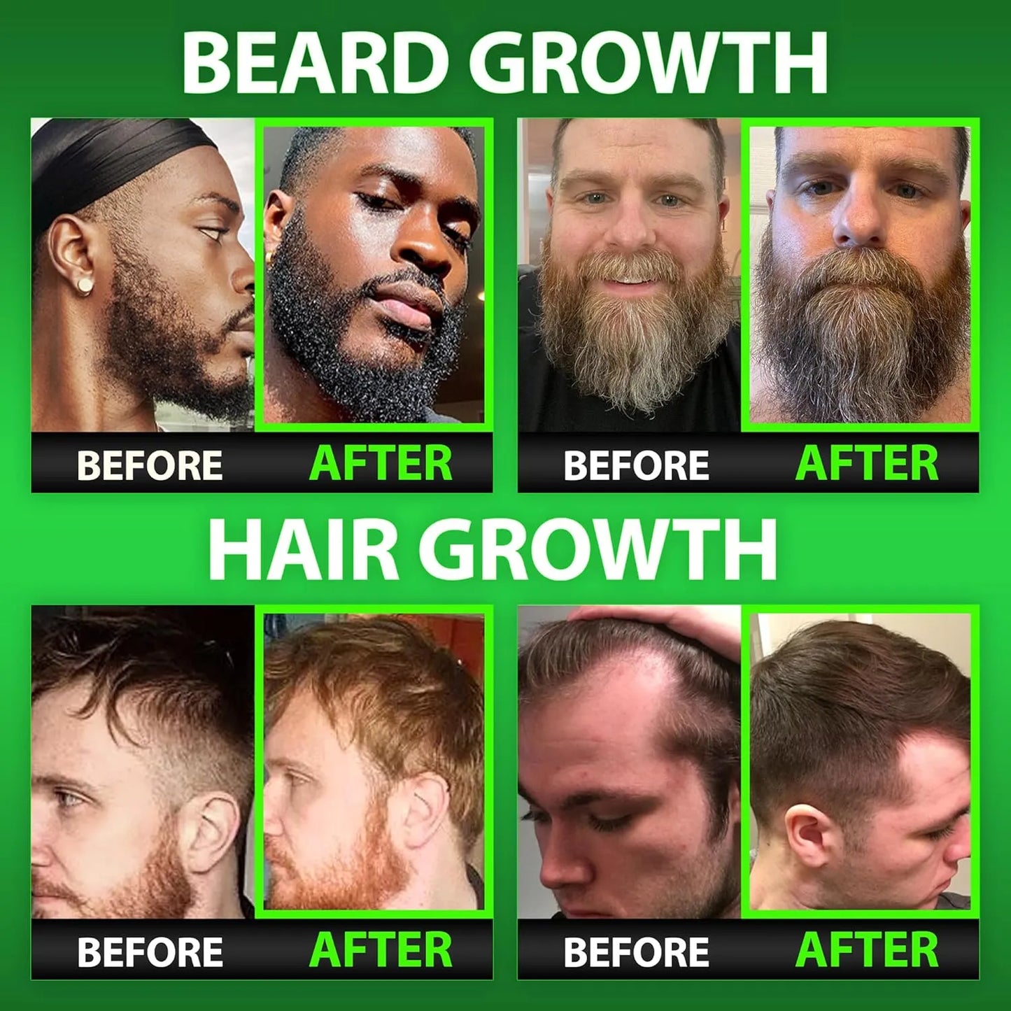 Vitaminas Para Barba Y Cabello Hombres Máxima Fuerza 620000 Mcg Biotina Colágeno MSM Queratina