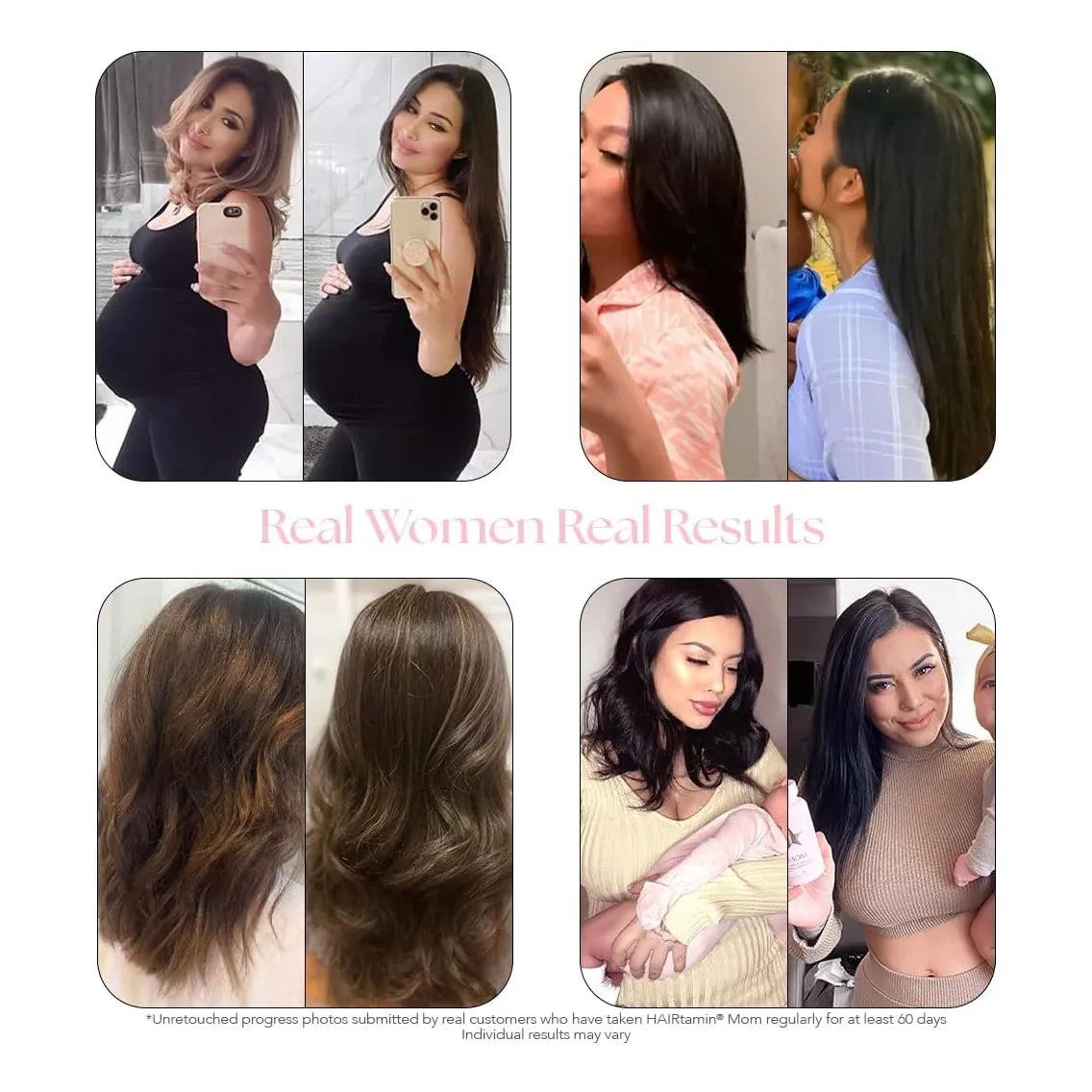 Vitaminas Prenatales Postnatales Hairtamin Mom Crecimiento Cabello Vegano