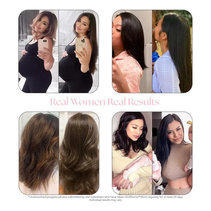 Vitaminas Prenatales Postnatales Hairtamin Mom Crecimiento Cabello Vegano