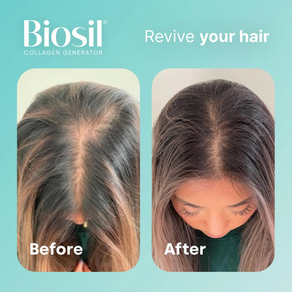 Gotas Líquidas De Colágeno Generador chOSA Piel Radiante Cabello Fuerte 2 Unidades