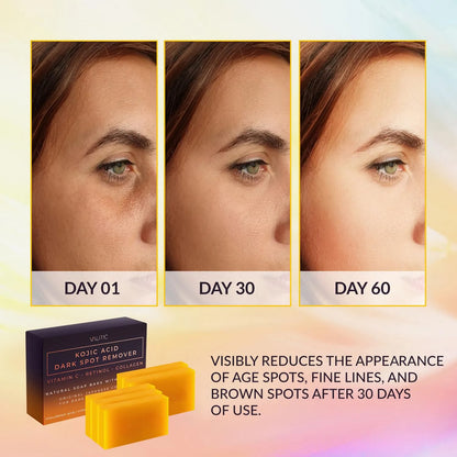 Jabón Exfoliante Manchas Oscuras Ácido Kójico Vitamina C Retinol Colágeno