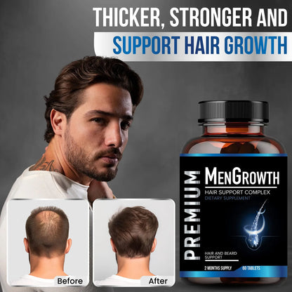 Vitaminas Crecimiento Cabello Hombres Anti Caída Con Bloqueador DHT