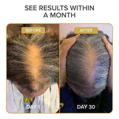 Vitaminas Naturales Para Crecimiento Rapido Del Cabello 60 Capsulas Veganas