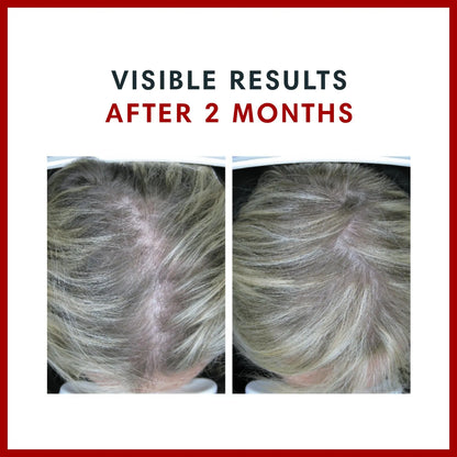Gomitas De Biotina Con Anagain 10000 Mcg Para Cabello Fuerte Y Saludable