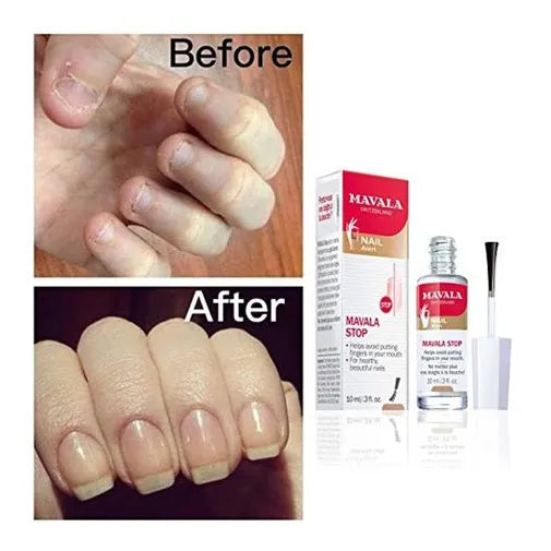 Esmalte De Uñas Antimordedura Para Evitar Morder - Imagen 4