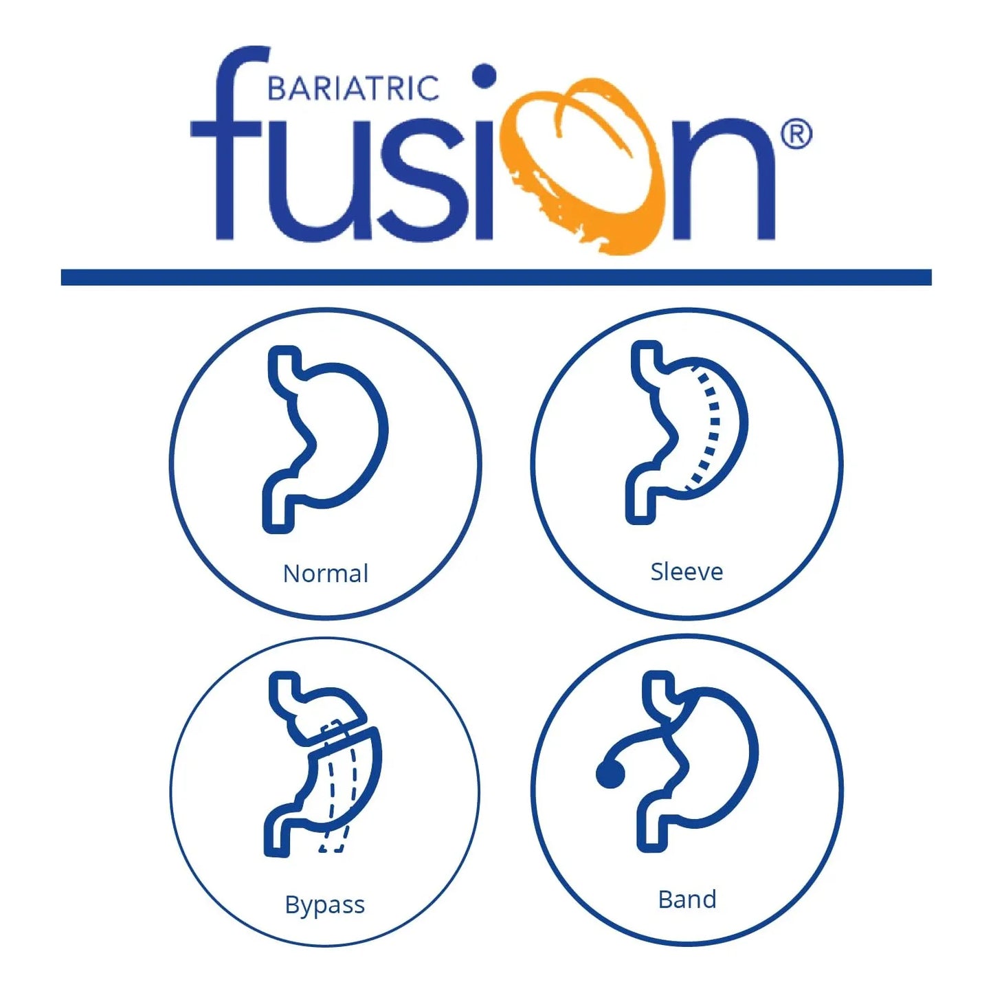 Bariatric Fusion Suplemento De Hierro Bariatrico 60 Capsulas Sabor Cereza Con Vitamina C