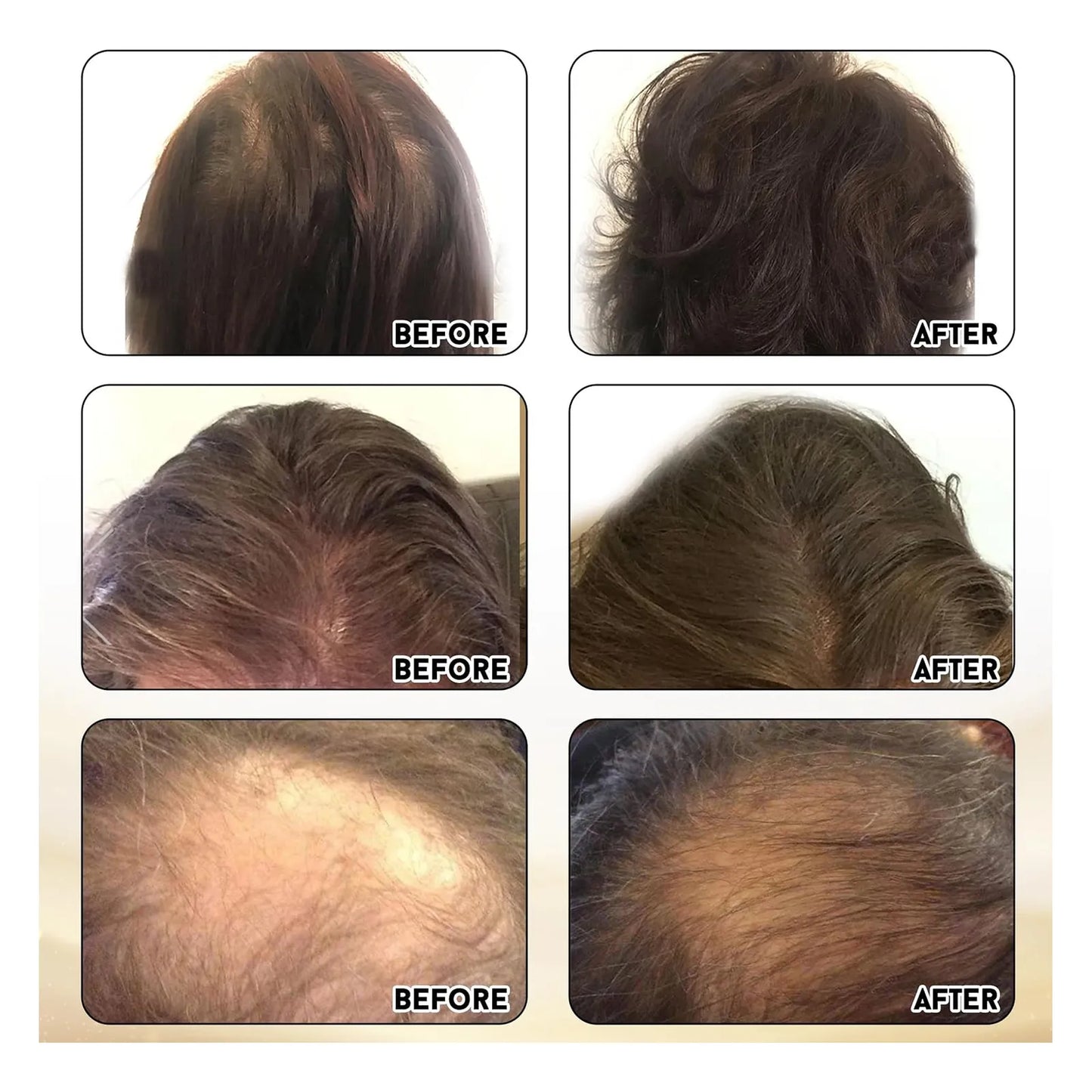 Cápsulas Fortalecer Cabello 180 Unidades Reduce Caída 90 Días Joyce Giraud