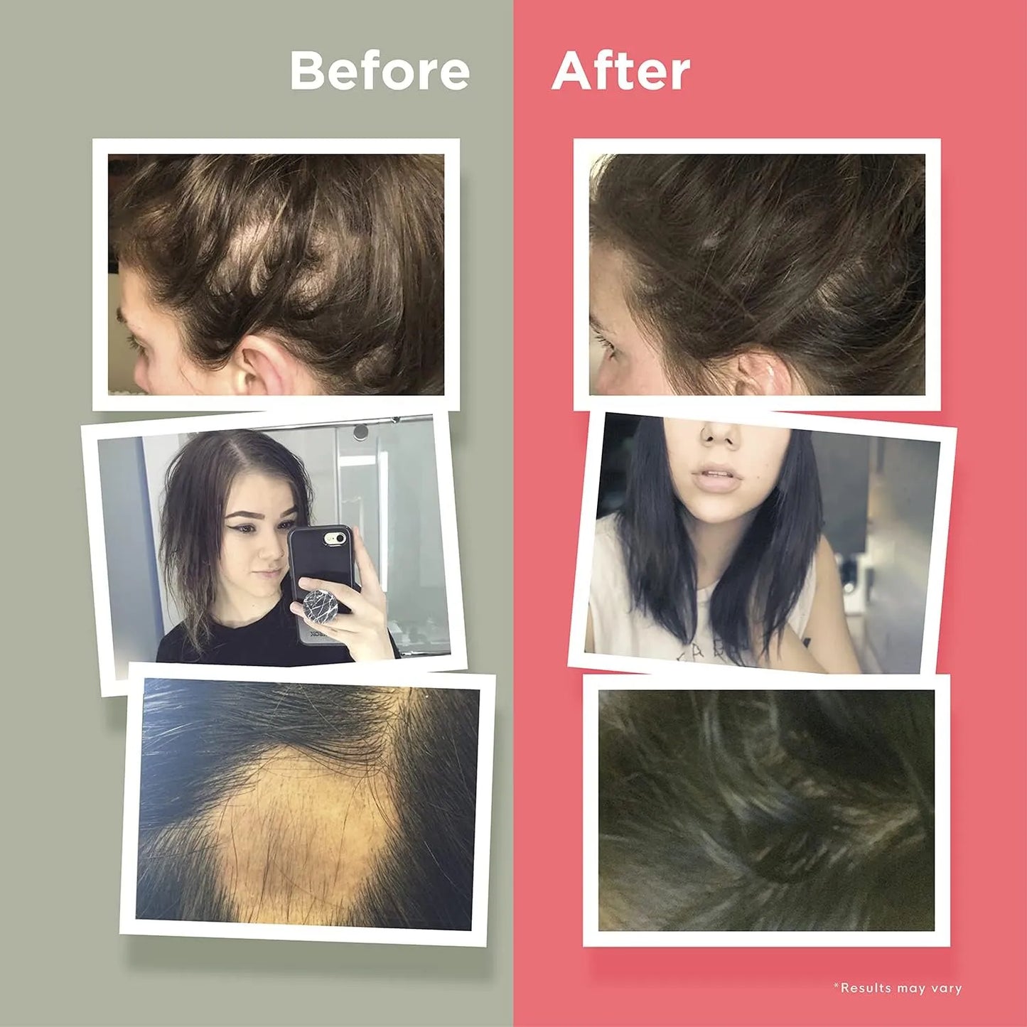 Vitaminas Crecimiento Cabello Con Biotina 60 Capsulas Hairanew Para Cabello Fuerte
