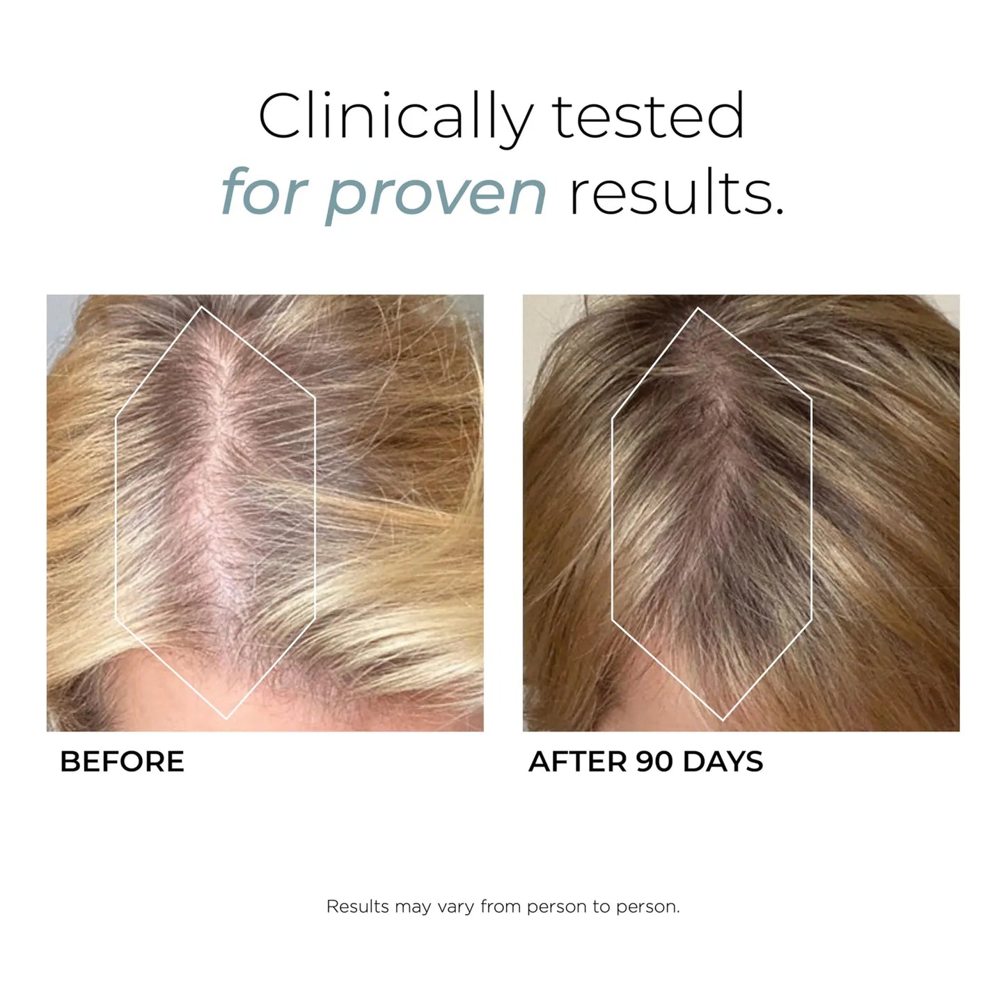 DeeplyRooted Suplemento Capilar Con Colágeno Y Biotina Para Cabello Fuerte Y Saludable