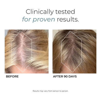 DeeplyRooted Suplemento Capilar Con Colágeno Y Biotina Para Cabello Fuerte Y Saludable