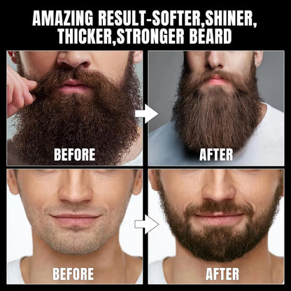 Kit De Aseo De Barba Completo Con Acondicionador Y Accesorios De Lujo XIKEZAN